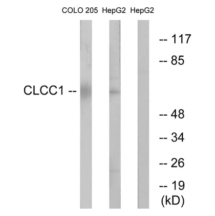 Western Blot - Anti-CLCC1 Antibody (C15076) - Antibodies.com