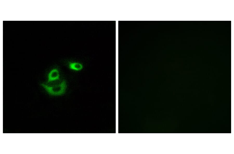 Immunofluorescence - Anti-CLCC1 Antibody (C15076) - Antibodies.com