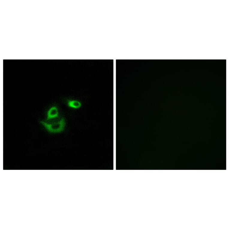 Immunofluorescence - Anti-CLCC1 Antibody (C15076) - Antibodies.com