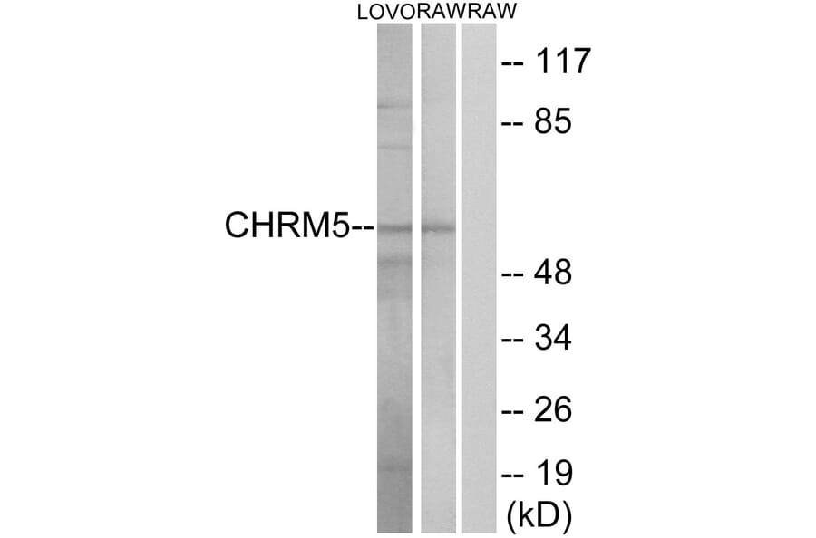 Western Blot - Anti-CHRM5 Antibody (G209) - Antibodies.com