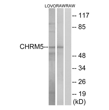 Western Blot - Anti-CHRM5 Antibody (G209) - Antibodies.com