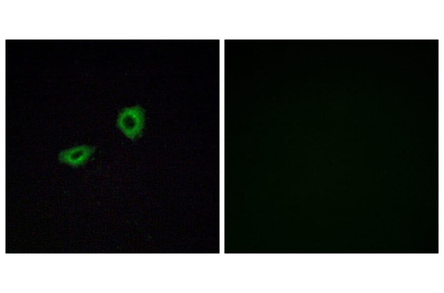 Immunofluorescence - Anti-CHRM5 Antibody (G209) - Antibodies.com