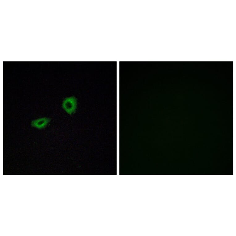 Immunofluorescence - Anti-CHRM5 Antibody (G209) - Antibodies.com
