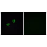 Immunofluorescence - Anti-CHRM5 Antibody (G209) - Antibodies.com