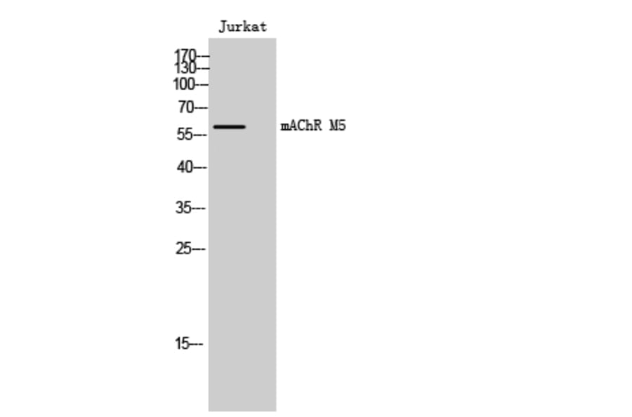 Western Blot - Anti-CHRM5 Antibody (G209) - Antibodies.com