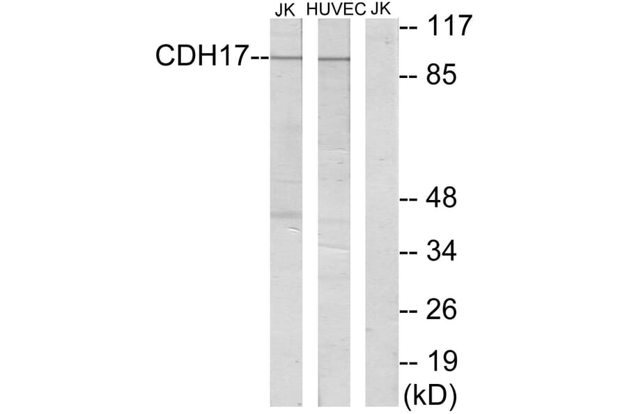 Western Blot - Anti-CDH17 Antibody (C12092) - Antibodies.com