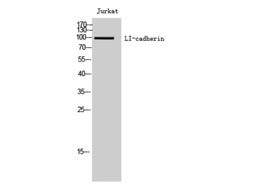 Western Blot - Anti-CDH17 Antibody (C12092) - Antibodies.com