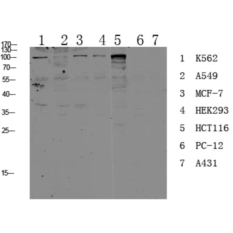 Western Blot - Anti-CDH17 Antibody (C12092) - Antibodies.com