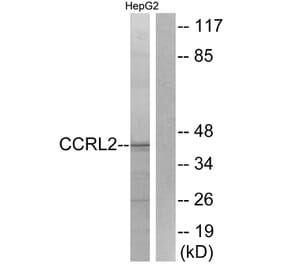 Western Blot - Anti-CCRL2 Antibody (G061) - Antibodies.com