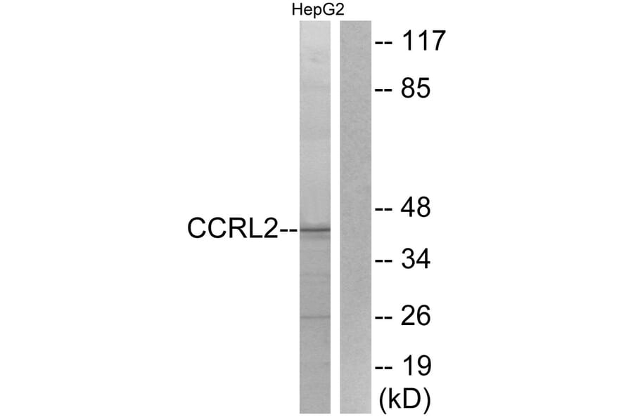 Western Blot - Anti-CCRL2 Antibody (G061) - Antibodies.com