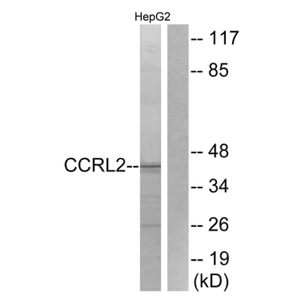 Western Blot - Anti-CCRL2 Antibody (G061) - Antibodies.com