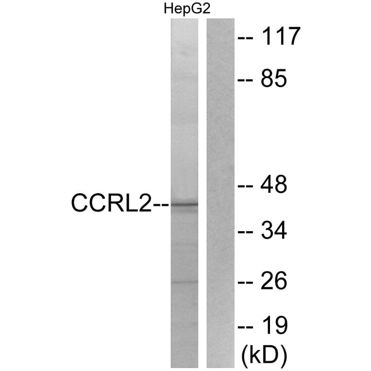 Western Blot - Anti-CCRL2 Antibody (G061) - Antibodies.com