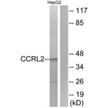 Western Blot - Anti-CCRL2 Antibody (G061) - Antibodies.com