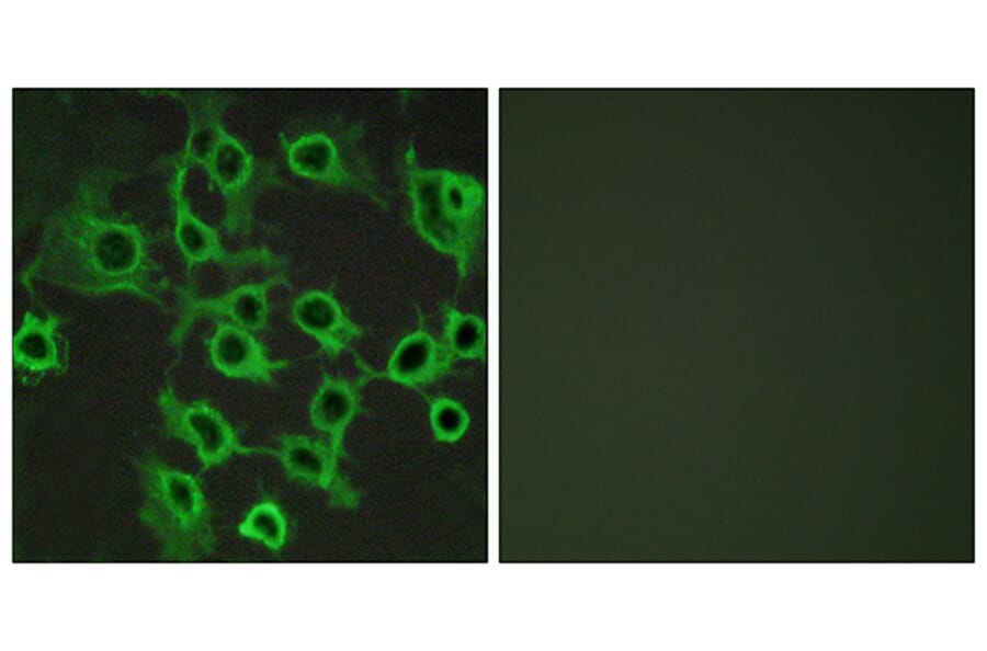 Immunofluorescence - Anti-CCRL2 Antibody (G061) - Antibodies.com