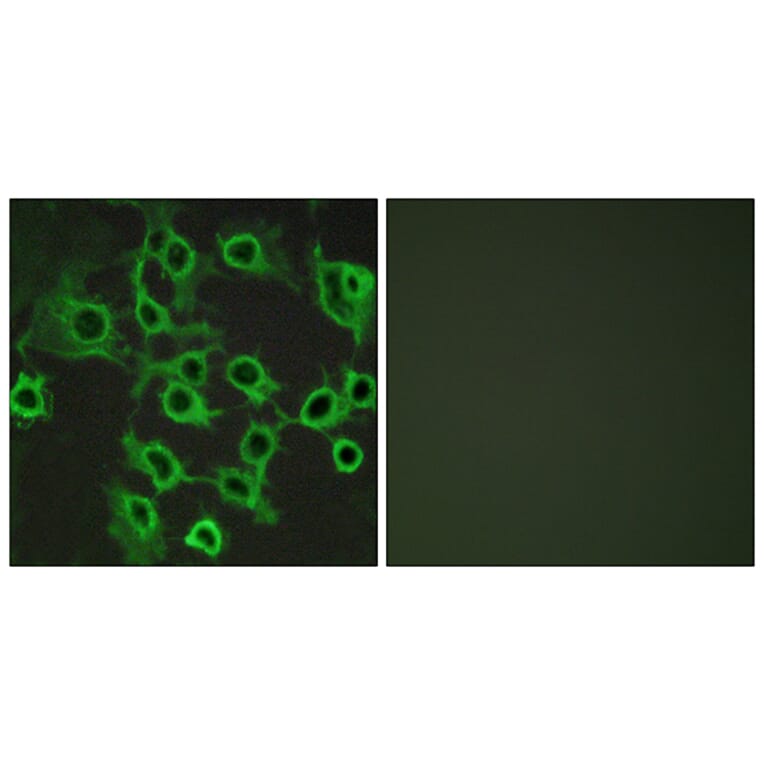 Immunofluorescence - Anti-CCRL2 Antibody (G061) - Antibodies.com