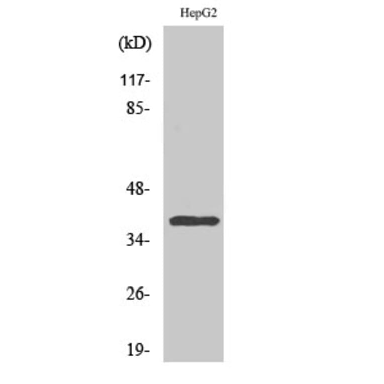 Western Blot - Anti-CCRL2 Antibody (G061) - Antibodies.com