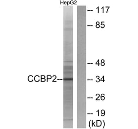 Western Blot - Anti-CCBP2 Antibody (G066) - Antibodies.com