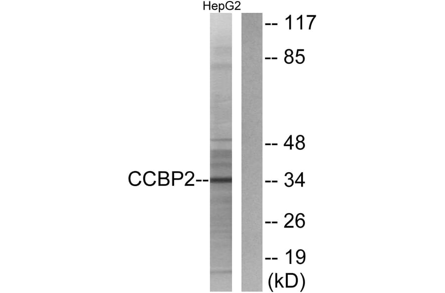 Western Blot - Anti-CCBP2 Antibody (G066) - Antibodies.com