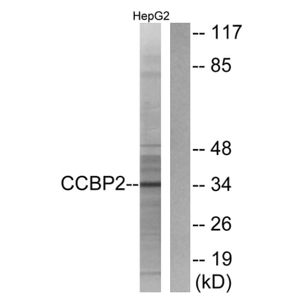 Western Blot - Anti-CCBP2 Antibody (G066) - Antibodies.com