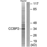 Western Blot - Anti-CCBP2 Antibody (G066) - Antibodies.com