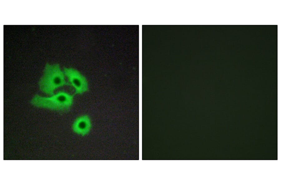 Immunofluorescence - Anti-CCBP2 Antibody (G066) - Antibodies.com