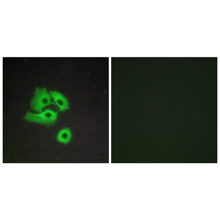 Immunofluorescence - Anti-CCBP2 Antibody (G066) - Antibodies.com