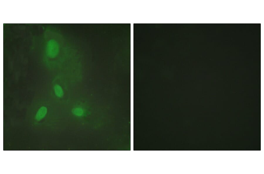 Immunofluorescence - Anti-BACH1 Antibody (C10055) - Antibodies.com