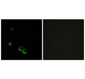 Immunofluorescence - Anti-AVPR2 Antibody (G788) - Antibodies.com