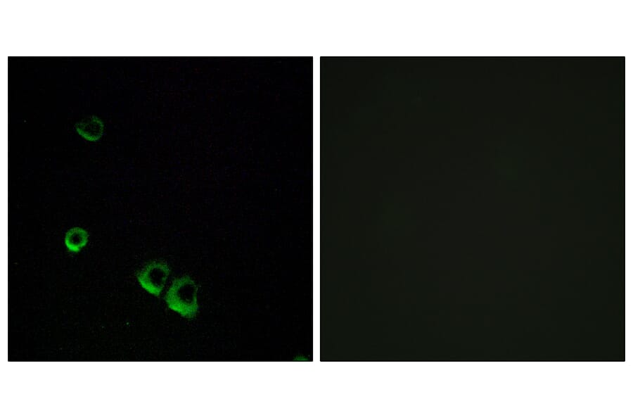 Immunofluorescence - Anti-AVPR2 Antibody (G788) - Antibodies.com