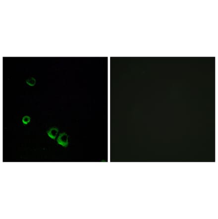 Immunofluorescence - Anti-AVPR2 Antibody (G788) - Antibodies.com