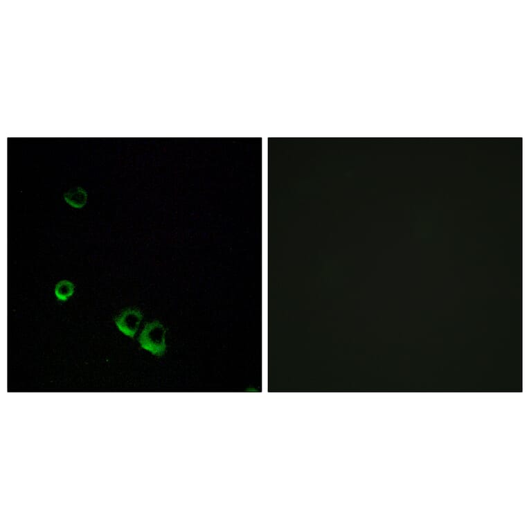 Immunofluorescence - Anti-AVPR2 Antibody (G788) - Antibodies.com