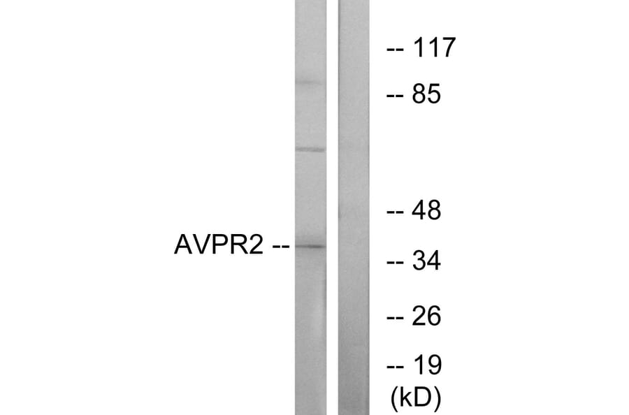Western Blot - Anti-AVPR2 Antibody (G788) - Antibodies.com