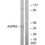 Western Blot - Anti-AVPR2 Antibody (G788) - Antibodies.com