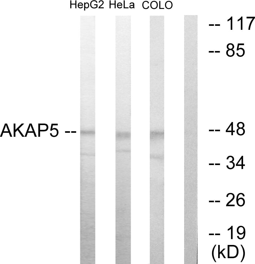 Western blot analysis of lysates from HepG HeLa, and COLO205 cells using Anti-AKAP5 Antibody. The right hand lane represents a negative control, where the antibody is blocked by the immunising peptide.