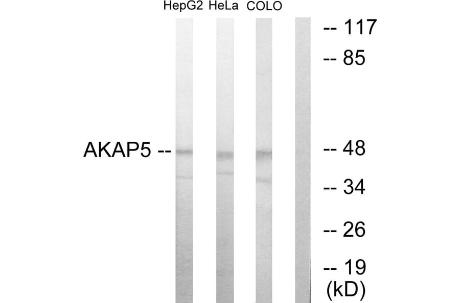 Western Blot - Anti-AKAP5 Antibody (C10472) - Antibodies.com