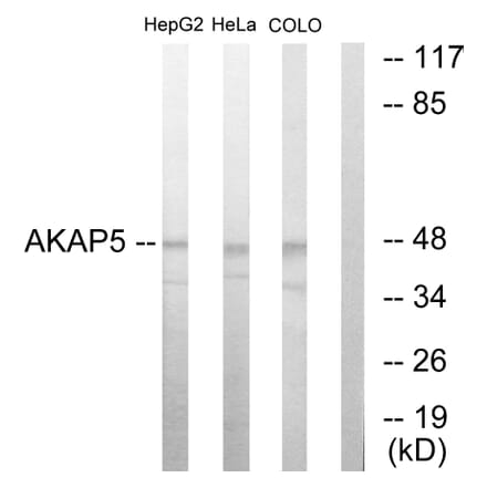 Western Blot - Anti-AKAP5 Antibody (C10472) - Antibodies.com