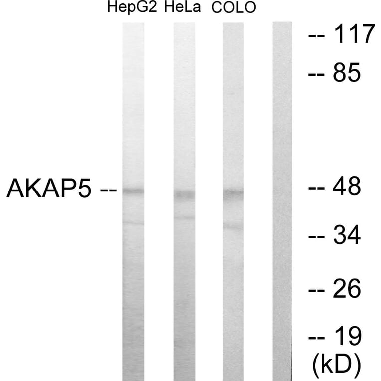 Western Blot - Anti-AKAP5 Antibody (C10472) - Antibodies.com