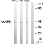 Western Blot - Anti-AKAP5 Antibody (C10472) - Antibodies.com