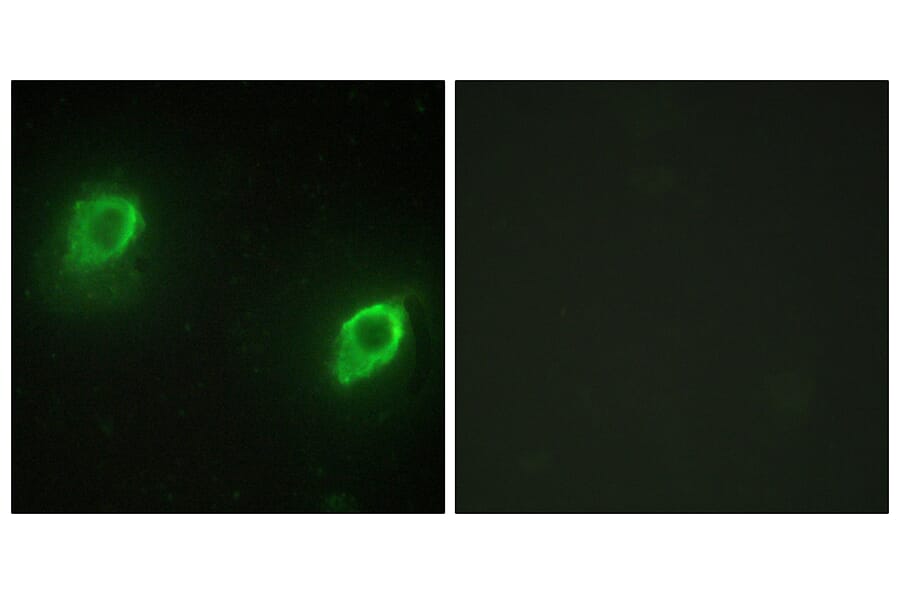 Immunofluorescence - Anti-AKAP5 Antibody (C10472) - Antibodies.com