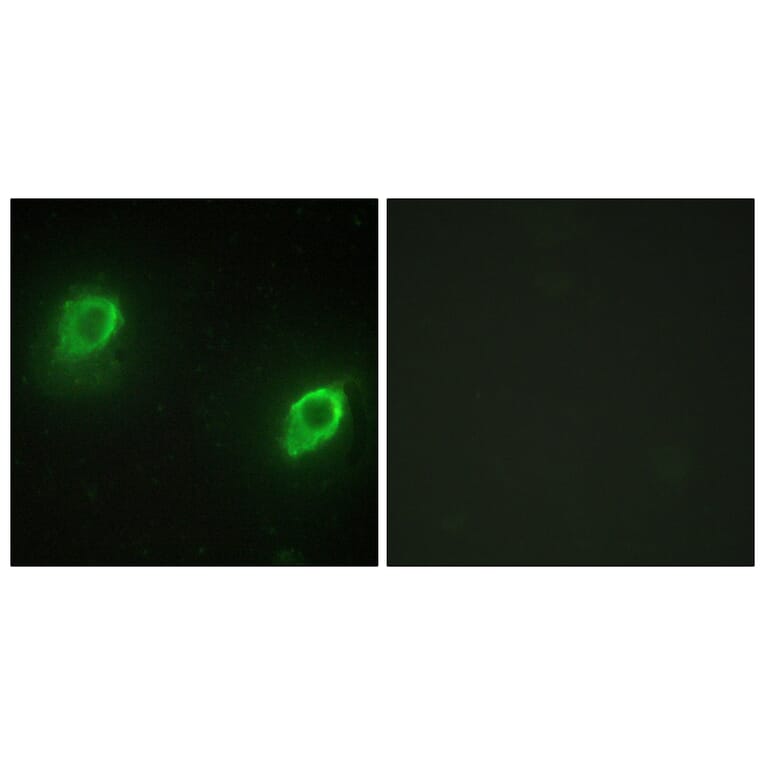 Immunofluorescence - Anti-AKAP5 Antibody (C10472) - Antibodies.com
