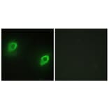 Immunofluorescence - Anti-AKAP5 Antibody (C10472) - Antibodies.com