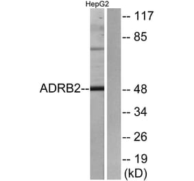 Western Blot - Anti-ADRB2 Antibody (G032) - Antibodies.com