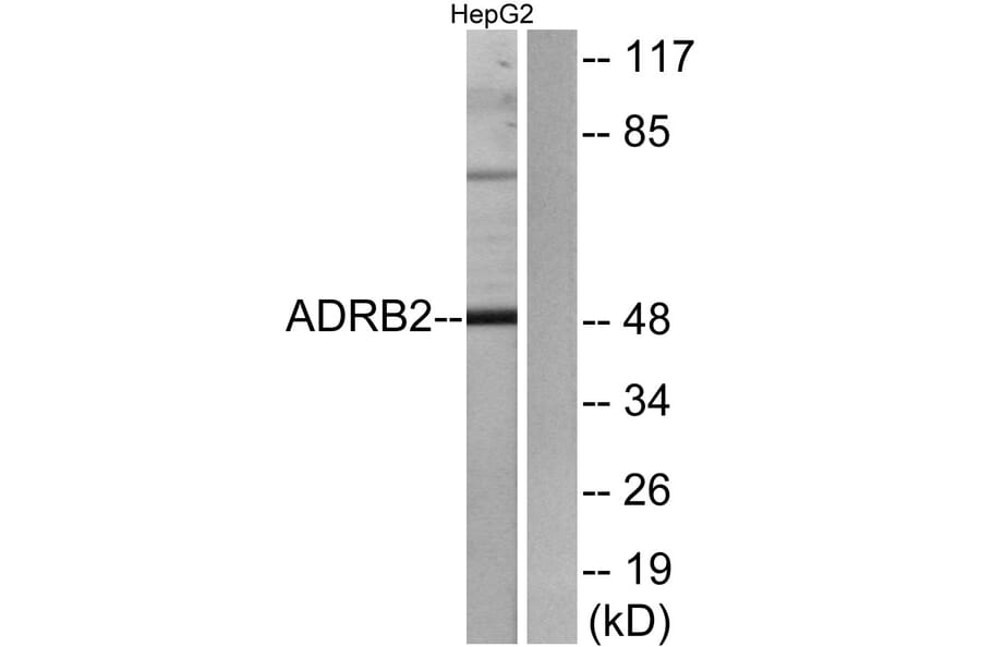 Western Blot - Anti-ADRB2 Antibody (G032) - Antibodies.com