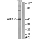 Western Blot - Anti-ADRB2 Antibody (G032) - Antibodies.com