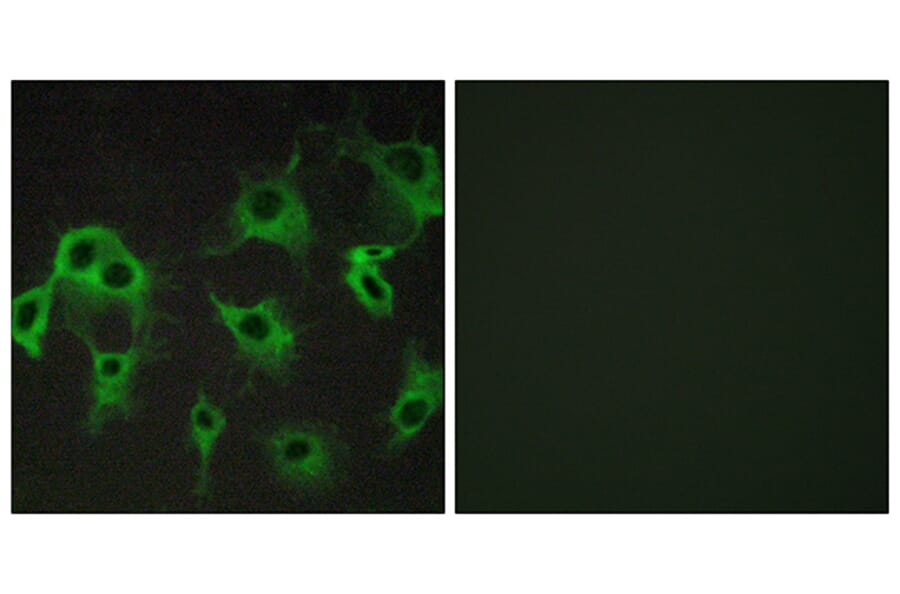 Immunofluorescence - Anti-ADRB2 Antibody (G032) - Antibodies.com