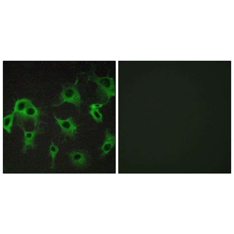 Immunofluorescence - Anti-ADRB2 Antibody (G032) - Antibodies.com