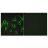 Immunofluorescence - Anti-ADRB2 Antibody (G032) - Antibodies.com