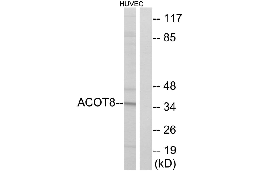 Western Blot - Anti-ACOT8 Antibody (C14273) - Antibodies.com