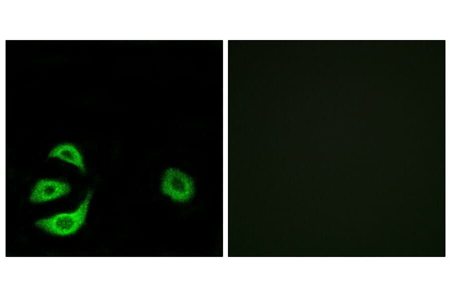 Immunofluorescence - Anti-ACOT8 Antibody (C14273) - Antibodies.com