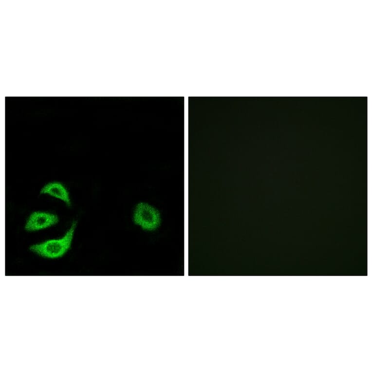 Immunofluorescence - Anti-ACOT8 Antibody (C14273) - Antibodies.com